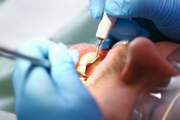 Best Broken or Chipped Tooth Repair in Meeker, OK