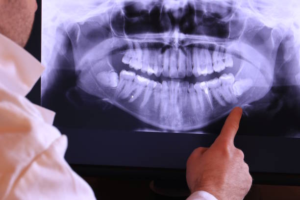 Best Emergency Treatment for Oral Infections in Meeker, OK