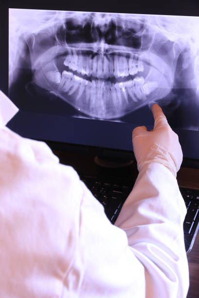 Best Broken or Chipped Tooth Repair in Meeker, OK