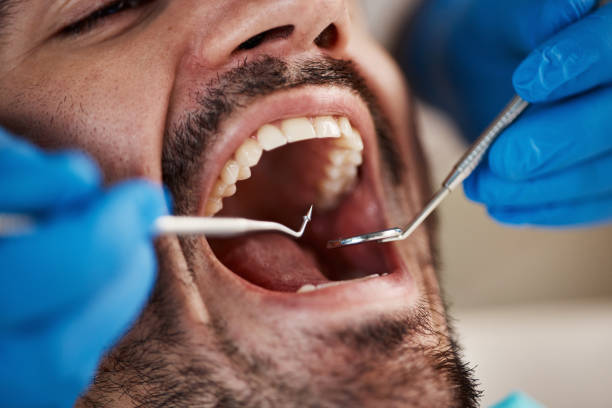 Best Urgent Dental Care for Toothaches in Meeker, OK